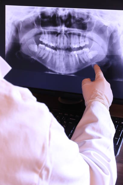 Best Emergency Dental Care for Broken or Chipped Teeth in Medford, MA