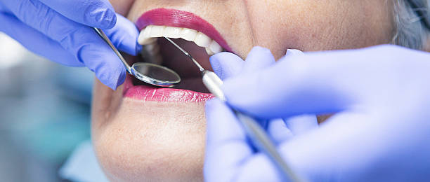 Best Urgent Care for Lost Fillings or Crowns in Medford, MA